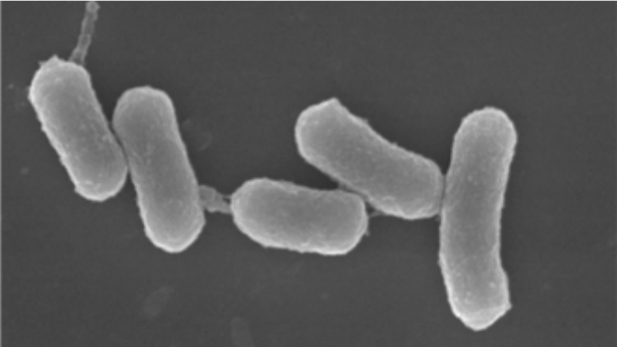 Imagem microscópica eletrônica de Porphyromonas gingivalis.